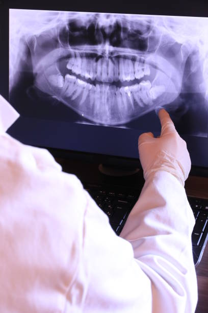 Best Emergency Tooth Extraction in Dupont, PA