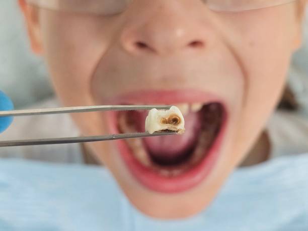 Best Pediatric Emergency Dentist in Dupont, PA