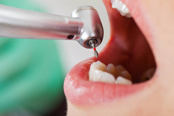 Best Emergency Broken Tooth Repair in Dupont, PA